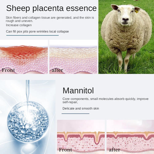 44PCS Sheep Placenta Oligopeptide Freeze-Dried Skin Care